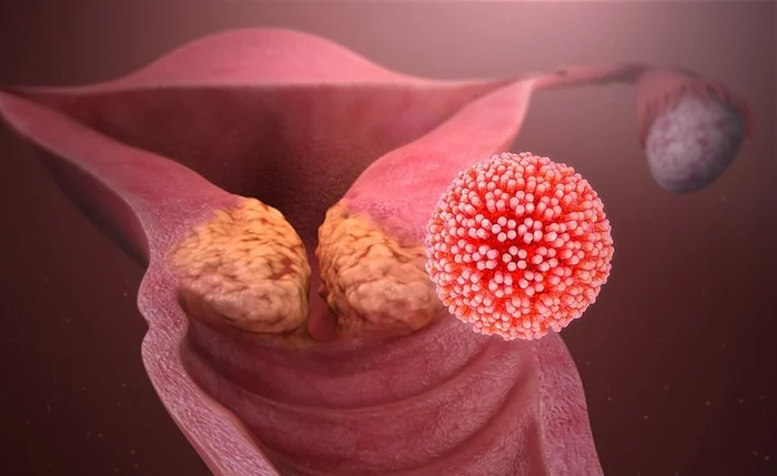 Alagoas pode registrar 350 casos de câncer do colo do útero em 2026